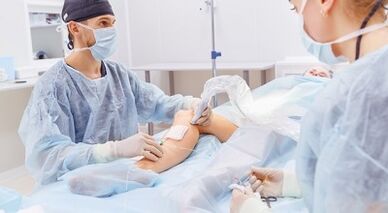 Chirurgie pour les varices