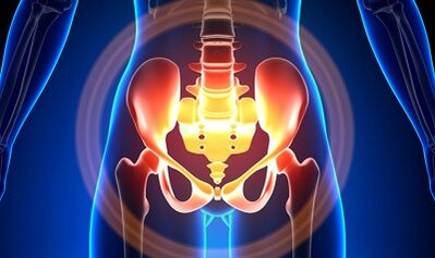 Les causes des varices du bassin